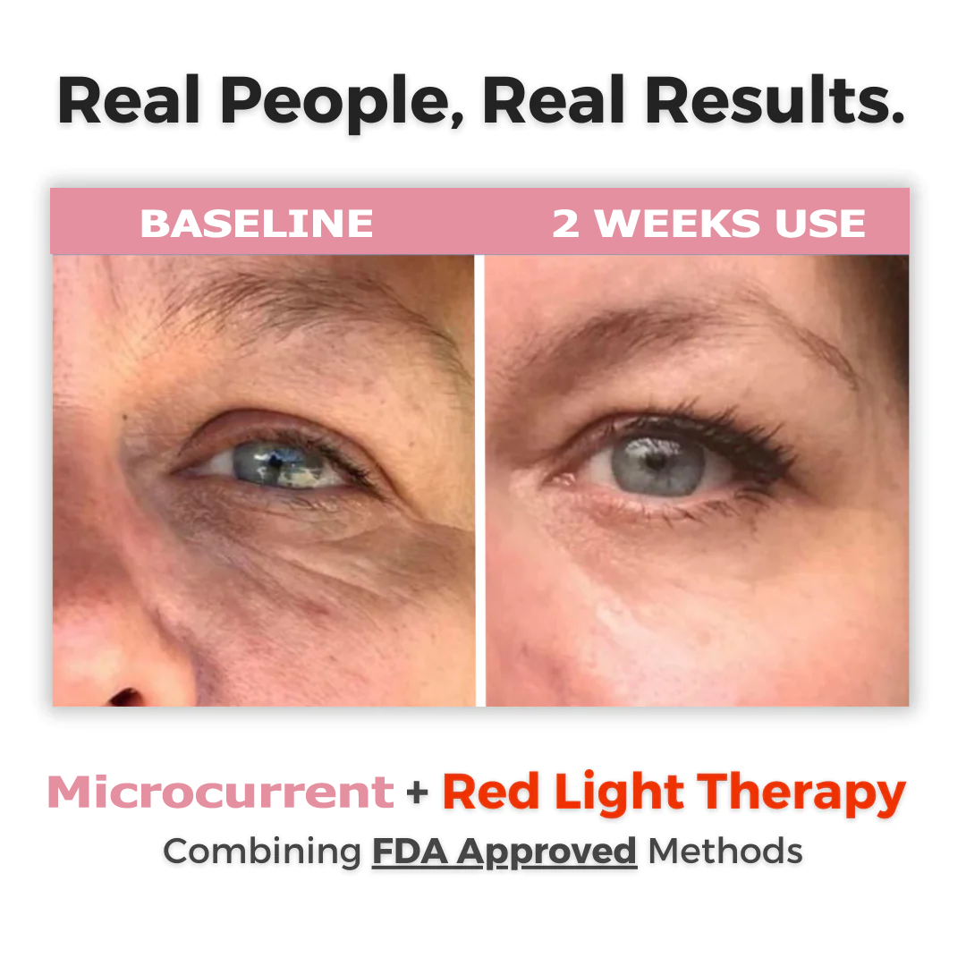 BeaThera™ Anti-Aging Pro