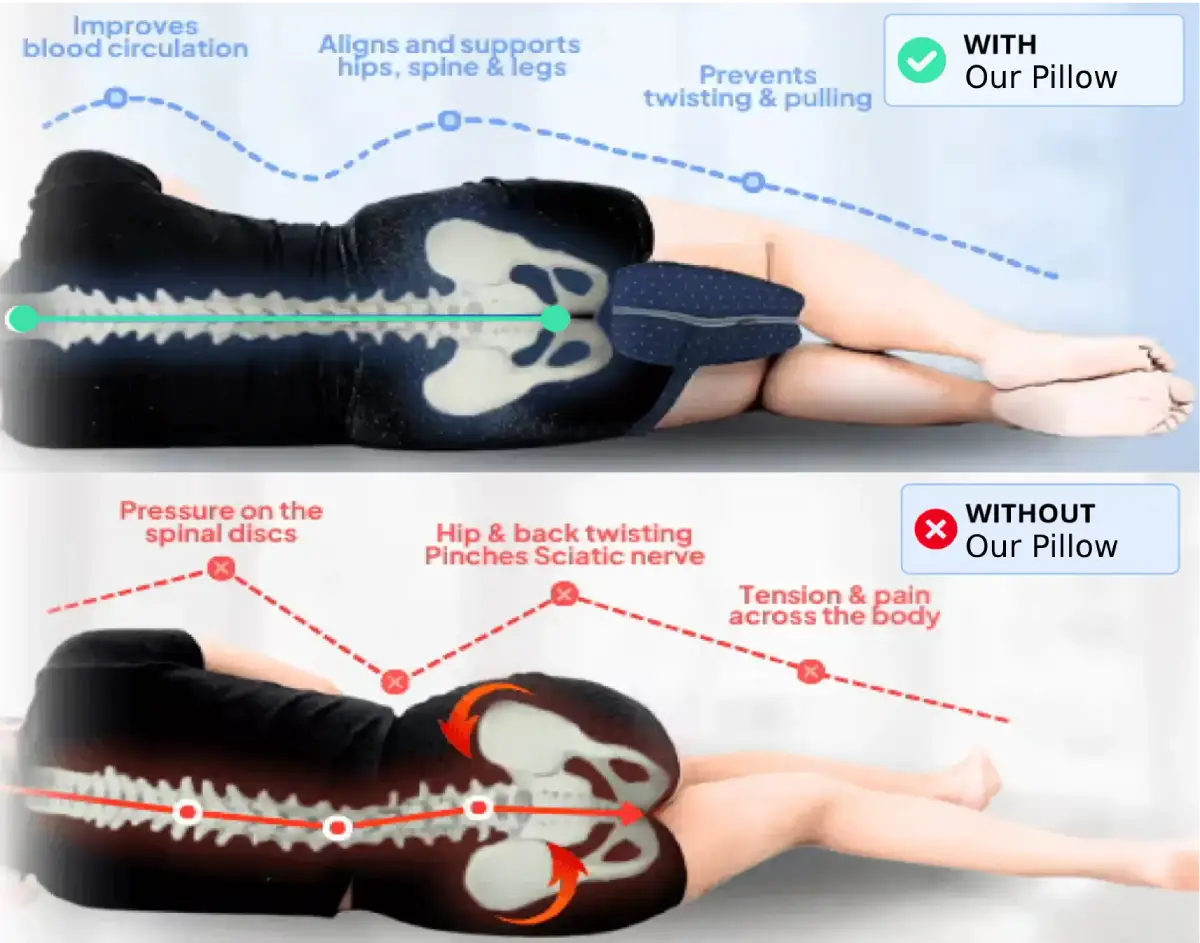 Alignment Pillow - Relieve Hip Pain & Sciatica